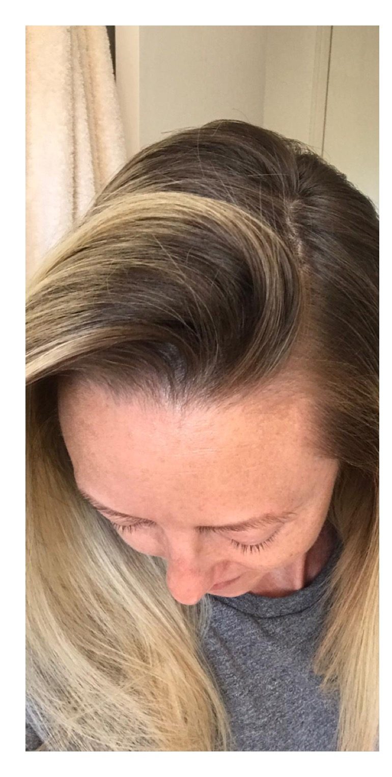 Roots before colouring