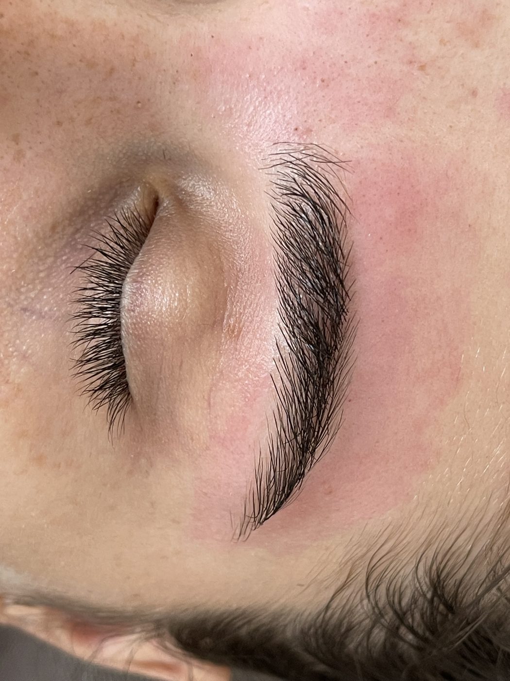 Restructuration des sourcils